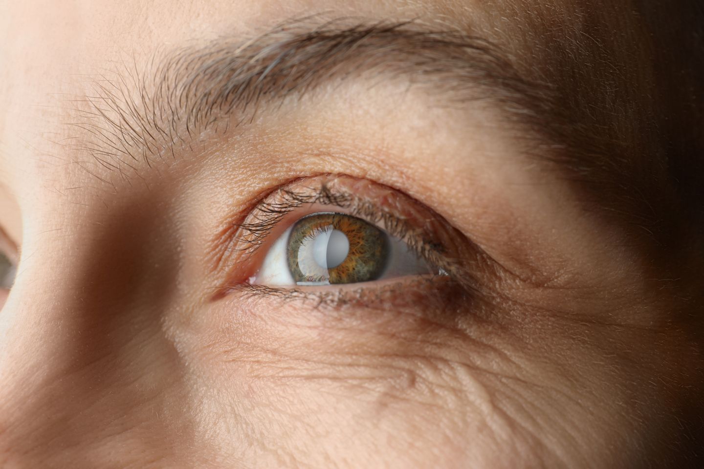 Could Vitamin B3 Help Prevent Glaucoma? What a New Study Really Shows